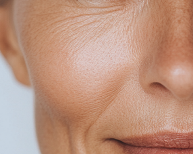 ¿Es necesario usar un contorno de ojos?
