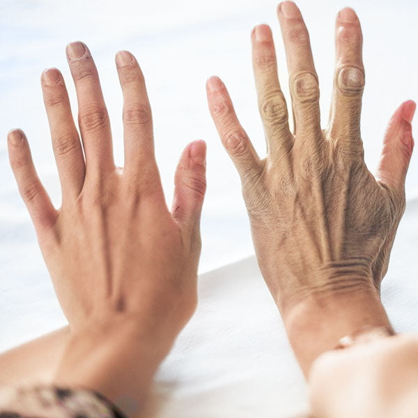 Cambios en la piel por el envejecimiento