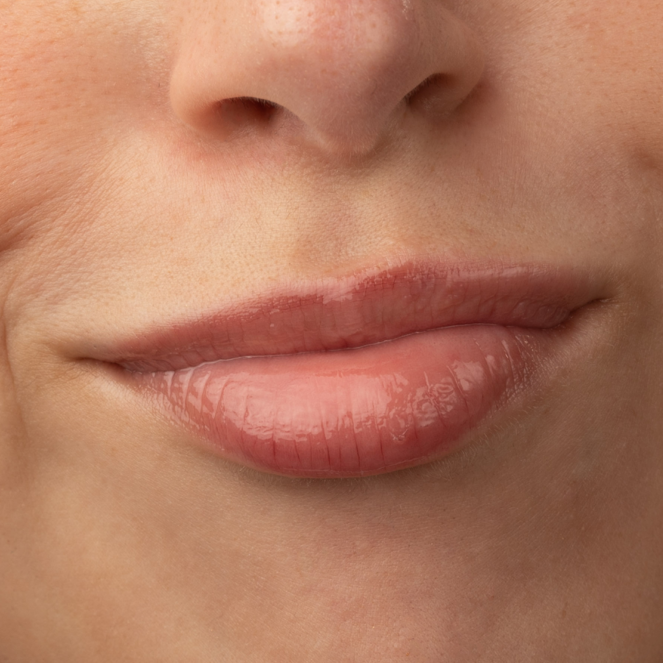 ¿Sabías que los labios son una de las zonas más vulnerables al sol?