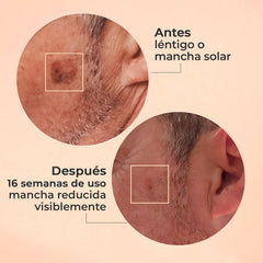 Sérum Glicolmix + Espuma