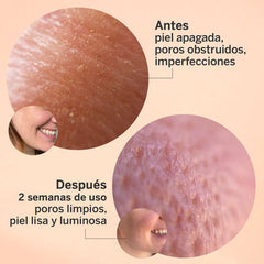 Sérum Glicolmix + Espuma + Solar SPF50