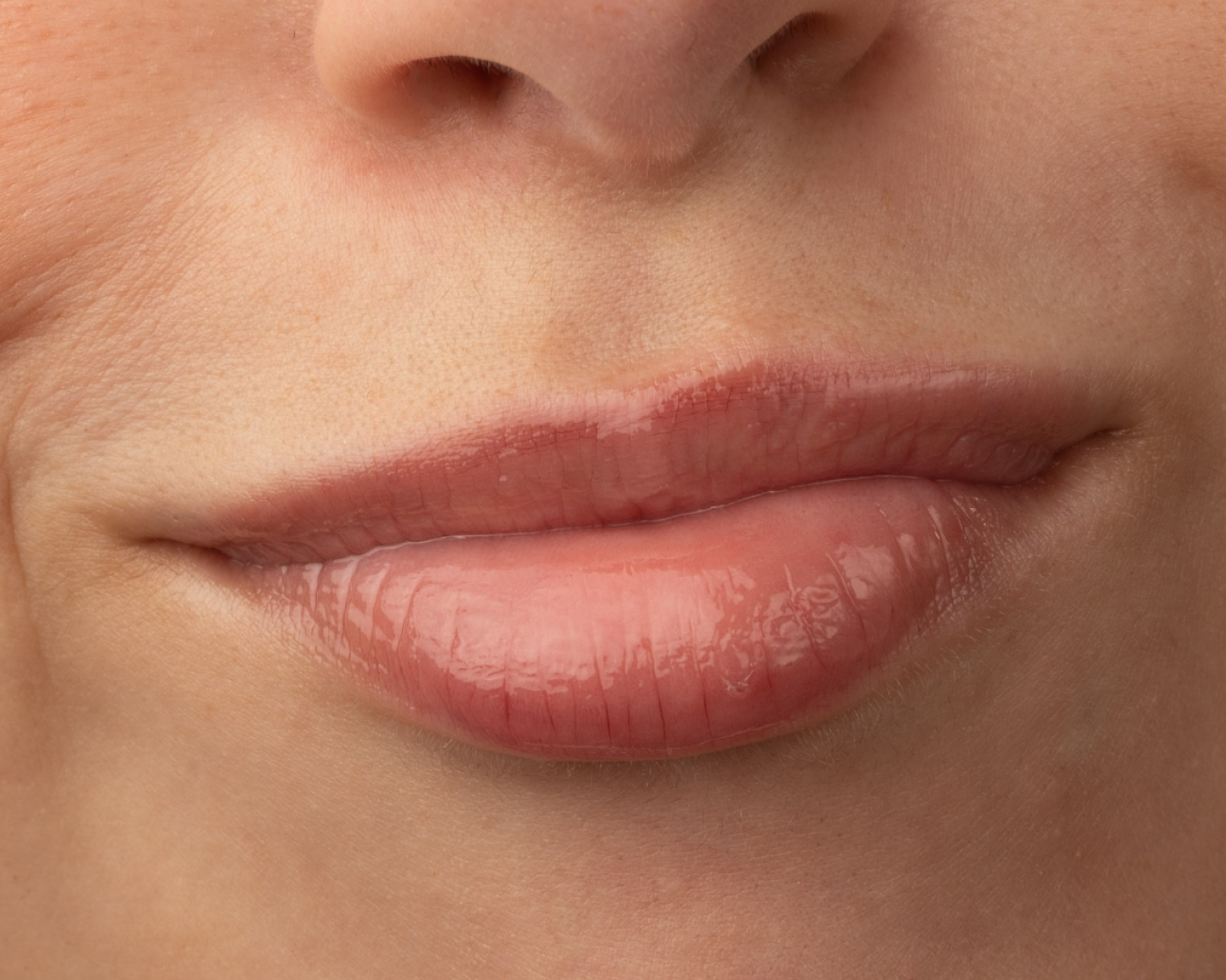 ¿Sabías que los labios son una de las zonas más vulnerables al sol?