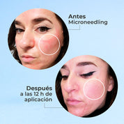 Pack Regenerador Piel Sensible