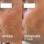 Pack Despigmentante + Glicolmix