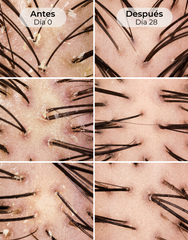 Sérum Capilar Scalp Exfoliating